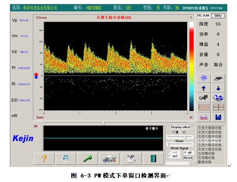 經(jīng)顱多普勒軟件pw模式下檢測(cè)界面.JPG