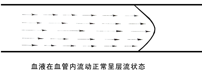 血液在血管內流動正常呈層流狀態.jpg