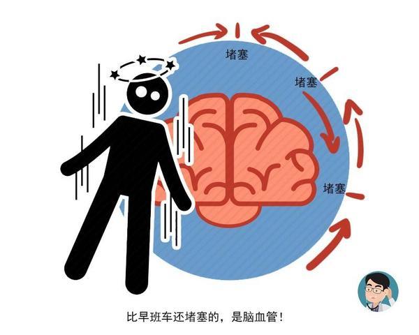 腦中風(fēng)發(fā)作前的四個癥狀 謹防中風(fēng)猝死